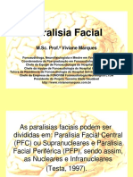 Paralisia Facial