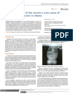 Duplication Cyst of The Cecum