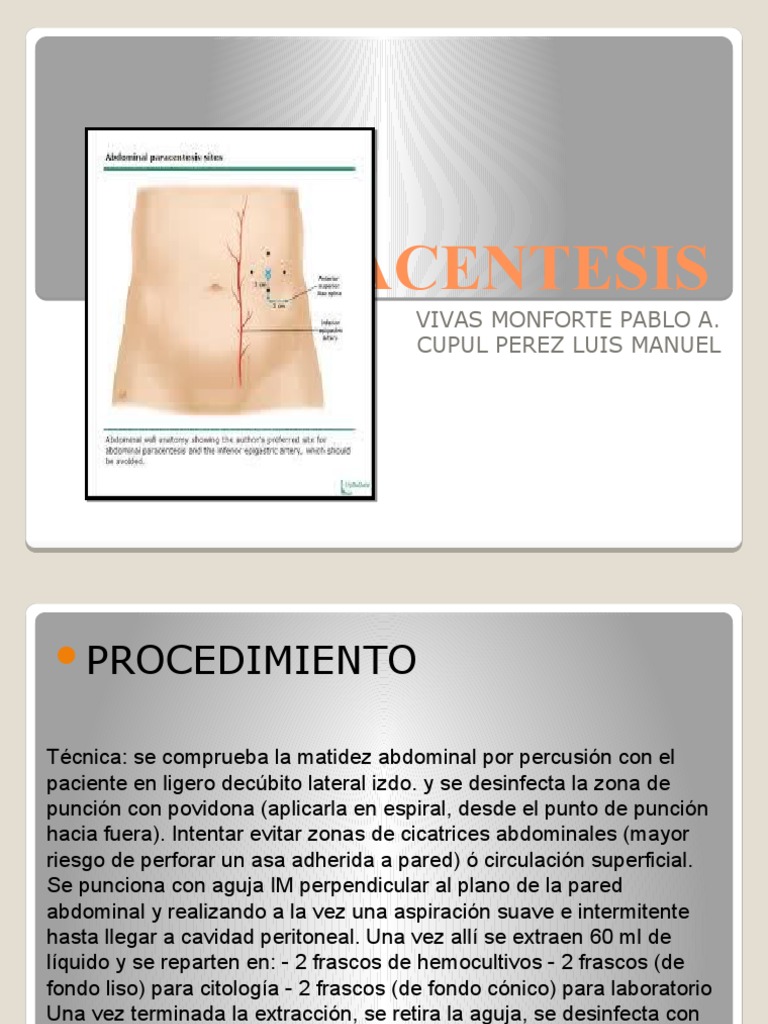 PARACENTESIS | PDF