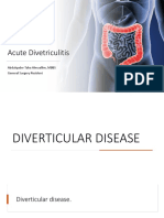 Acute Divetriculitis