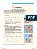 Preventing Deep Vein Thrombosis: Elevation
