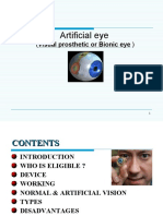 Artificial Eye: (Visual Prosthetic or Bionic Eye)