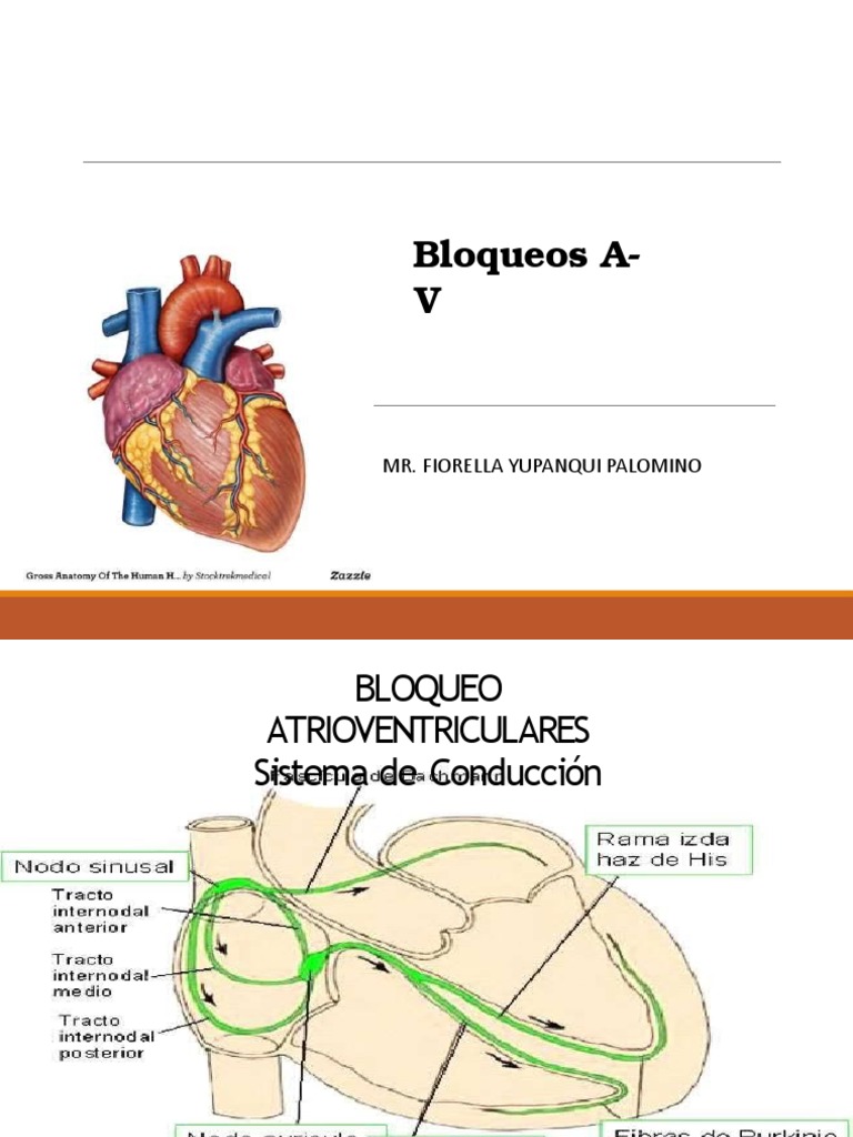 Clasificaci n De Bloqueos Atrioventriculares PDF 