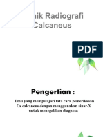 TR Calcaneus