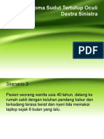 Glaucoma Sudut Tertutup Oculi Dextra Sinistra