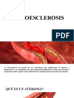 ATEROESCLEROSIS