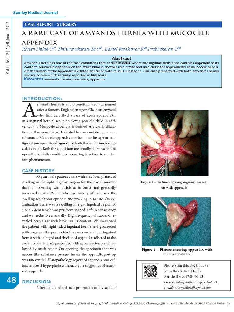 A R Are Case of Amyands Hernia With Mucocele Appendix | PDF | Diseases ...