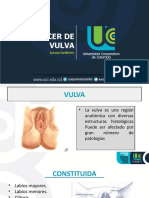 Cancer de vulva