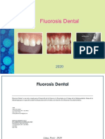 Fluorosis Dental