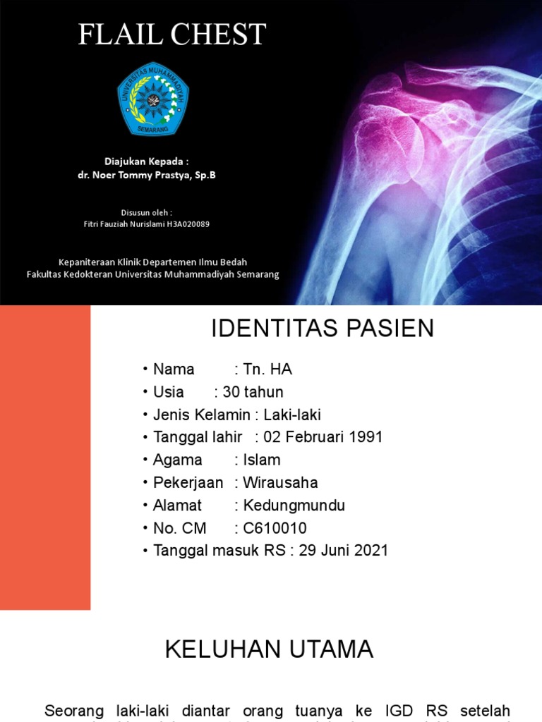 Flail Chest | PDF