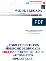 Sindrome de Brugada 160129111456