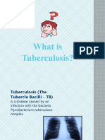 Tuberculosis