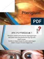 Pterigium