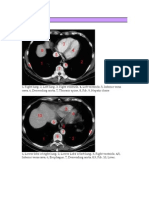 CT Abdomen