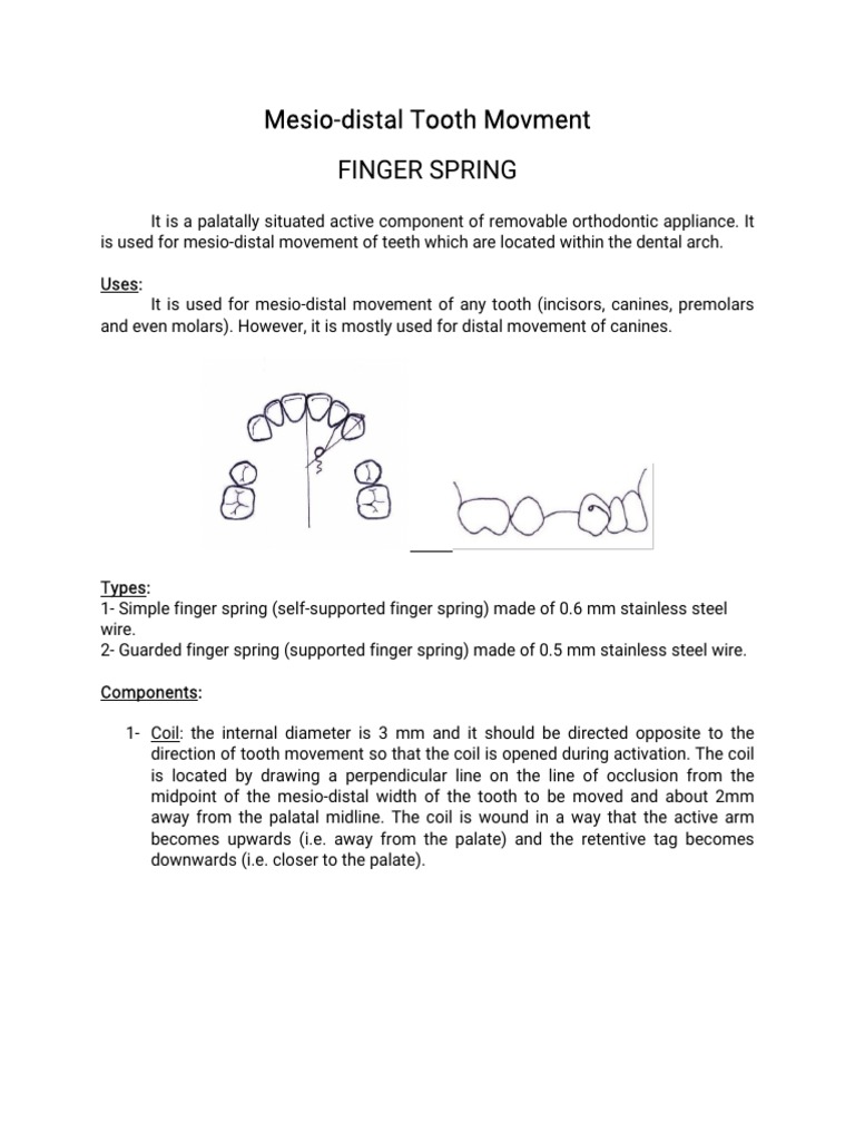 Finger Spring for Mesio-Distal Movement | PDF