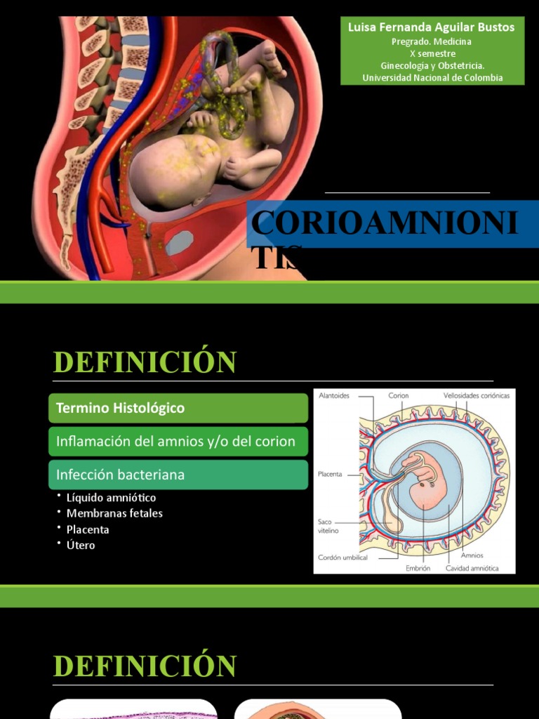 CORIOAMNIONITIS Descargar gratis PDF Placenta Parto