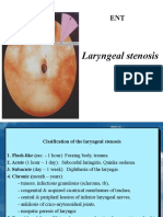 Stenosis and Tracheostomy