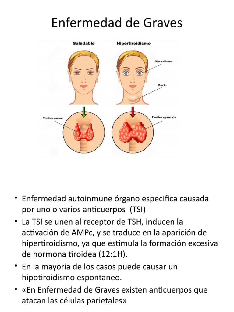 enfermedad intelligence overview