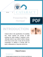 Cataract: Presented By: Homipal