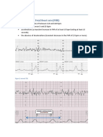 Criteria of Normal Fetal Heart Rate (FHR)