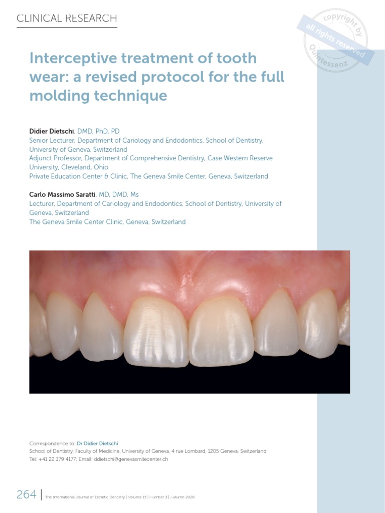 The Tooth Preparation※裁断済 書籍詳細「The Tooth Preparation」 | フォルディネット
