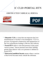 Ethanolic Cld+Portal HTN: Obstructed Umbilical Hernia
