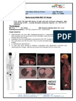 Clinical Data: Patient Name: Age: 50 Years Referring Physician: Date: 4/7/2020 Whole Body FDG PET CT Study