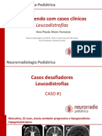 Leucodistrofias Pediátricas: 5 Casos Desafiadores