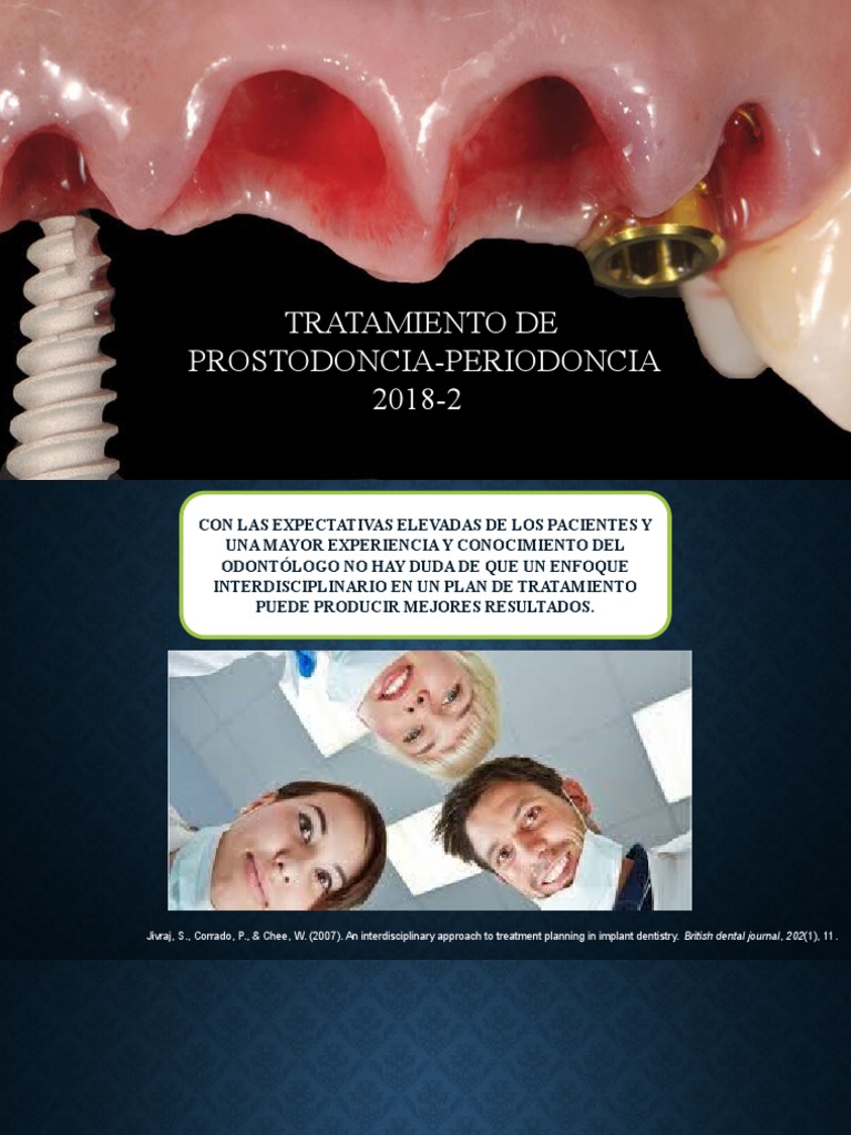 Relción Prosto Perio (1) PDF Implante dental Ramas de Odontología