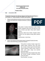 Tugas Kuliah Studi Kasus Radiologi Des 2020 - Indrianingtiyas - 185130100111043 - d-2018