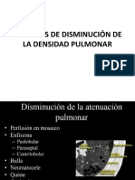 Patrones Disminucion