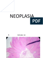 Neoplasia Prac 1