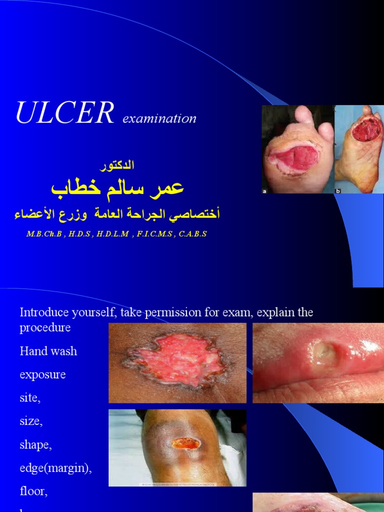 Lump Examination 2 | PDF