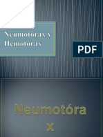 Neumotorax y Hemotorax