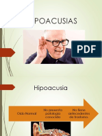 Hipoacusias Completa2