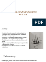 Lateral Condyle Fractures in Children: Anatomy, Mechanism, Classification and Management