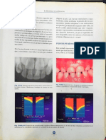 Odontología Pediátrica.387-400, 400-406.Office Lens