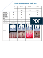 Tabla Clasificación Recesiones Gingivales