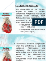 Cardiac Arrhytmia