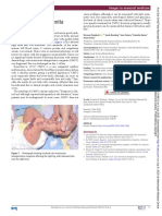 Cutis Marmorata Telangiectatica Congenita: Images in Neonatal Medicine