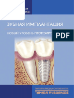 Зубная Имплантация Новый Уровень Протезирования