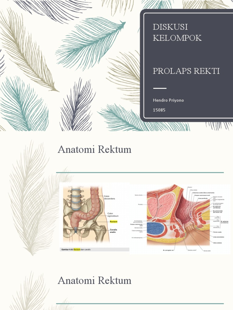 Prolaps Rektum: Diagnosis dan Tatalaksana | PDF | Sains & Matematika
