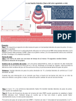 Caso 9 1X y Los Armónicos Tienen Una Falda de Bandas Laterales (Barra Del Rotor Agrietada) (Barras Del Rotor Agrietadas o Rotas)