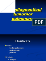 Curs5 - Radiodiagnosticul Tumorilor Pulmonare - Prelucrat2