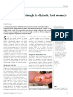 Management of Slough in Diabetic Foot Wounds: Steve Young