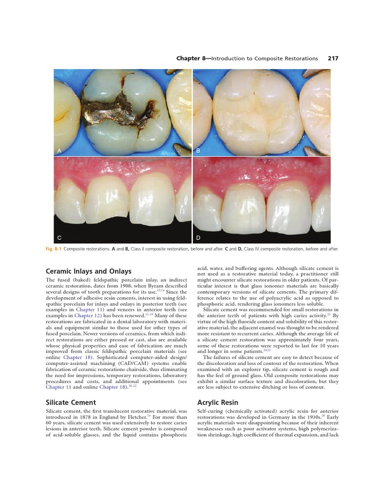 Dental Restoration Techniques | PDF | Health Sciences | Dentistry Branches