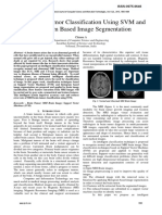 MRI Brain Tumor Classification Using SVM and Histogram Based Image Segmentation