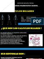 Calculos biliares: causas, síntomas y prevención