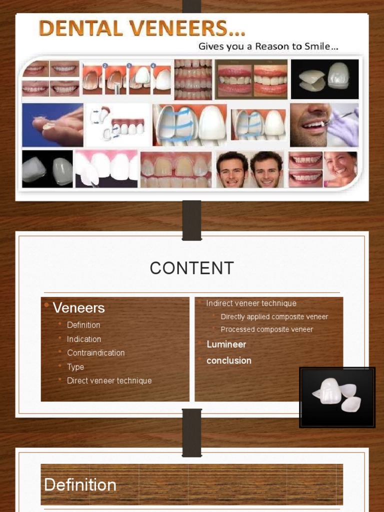 Comprehensive Guide to Dental Veneers | PDF | Mouth | Dentistry