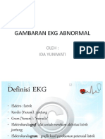 Gambaran Ekg Abnormal